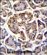 FAM218A Antibody (RB29001)