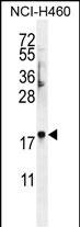 FAM218A Antibody (RB29001)