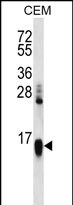 HIST1H2AA Antibody (RB31378)