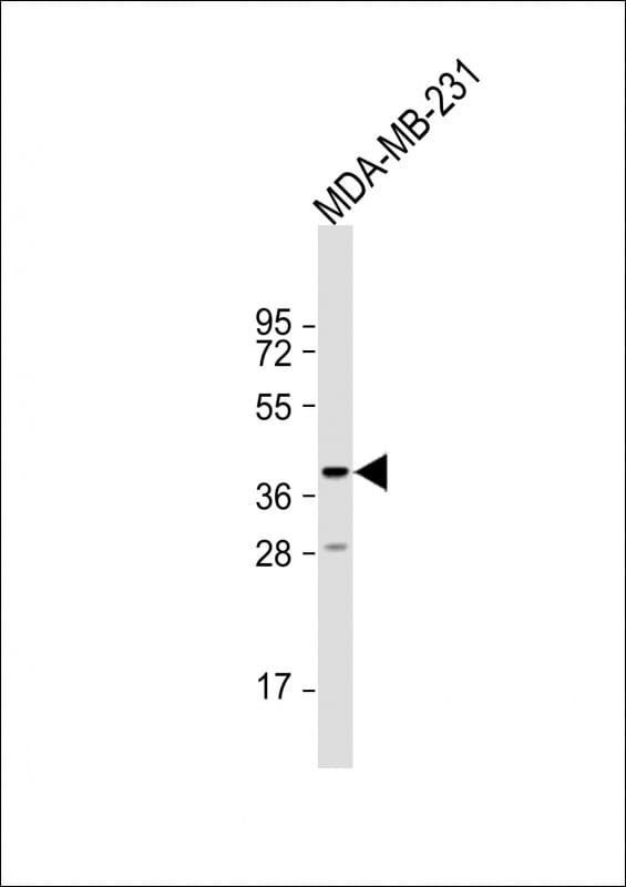 TAS2R44 Antibody (RB35870)