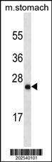 LYPD6B Antibody (634CT7.10.1)