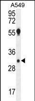 Aquaporin 12B Antibody (RB29754)