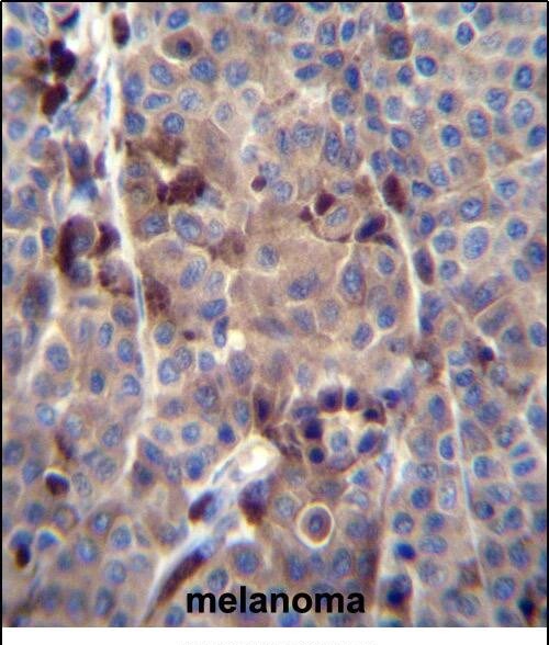 PRAMEF8 Antibody (RB29974)