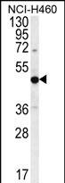 PRAMEF8 Antibody (RB29974)