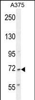 ALS2CR11 Antibody (RB28453)