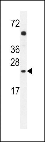 GOLGA2P5 Antibody (RB27834)
