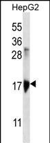 KRTAP1-3 Antibody (RB29851)