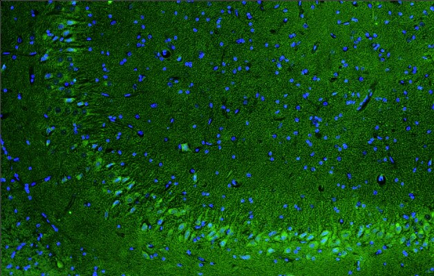 Immunohistochemistry-Paraffin: Scn1a Antibody (K74/71) - Chimeric - BSA Free [NBP3-52336]