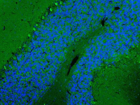 Immunohistochemistry-Paraffin: Scn1a Antibody (K74/71) - Chimeric - Azide and BSA Free [NBP3-52337]