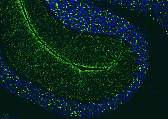 Immunohistochemistry-Paraffin: VGLUT2 Antibody (N29/29) - Chimeric - Azide and BSA Free [NBP3-52339]