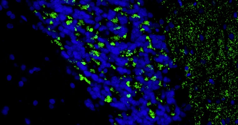 Immunohistochemistry-Paraffin: VGLUT2 Antibody (N29/29) - Chimeric - Azide and BSA Free [NBP3-52339]