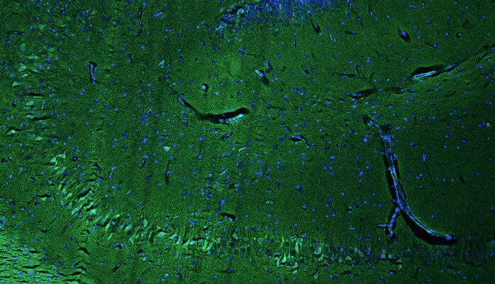 Immunohistochemistry-Paraffin: RGS14 Antibody (N133/21) - Chimeric - Azide and BSA Free [NBP3-52343]