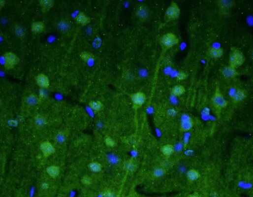 Immunohistochemistry-Paraffin: SPTBN4 Antibody (N393/76) - Chimeric - BSA Free [NBP3-52346]
