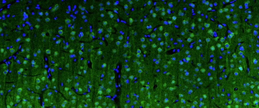 Immunohistochemistry-Paraffin: SPTBN4 Antibody (N393/76) - Chimeric - BSA Free [NBP3-52346]