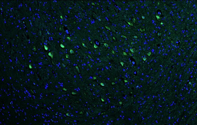 Immunohistochemistry-Paraffin: VAChT/SLC18A3 Antibody (N425/45) - Chimeric - BSA Free [NBP3-52348]