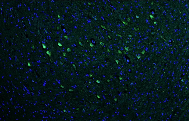 Immunohistochemistry-Paraffin: VAChT/SLC18A3 Antibody (N425/45) - Chimeric - Azide and BSA Free [NBP3-52349]