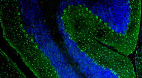 Immunohistochemistry-Paraffin: Parvalbumin Antibody (L114/81) - Chimeric - BSA Free [NBP3-52350]