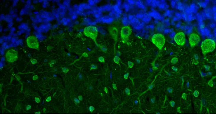 Immunohistochemistry-Paraffin: Parvalbumin Antibody (L114/81) - Chimeric - BSA Free [NBP3-52350]