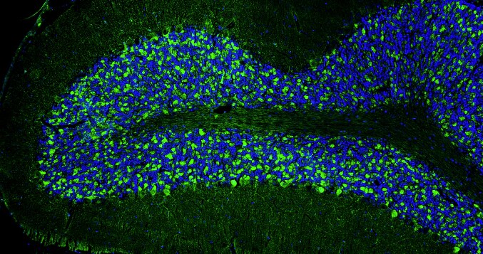 Immunohistochemistry-Paraffin: Bassoon Antibody (L124/59) - Chimeric - BSA Free [NBP3-52352]
