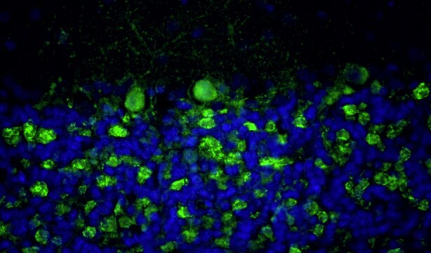 Immunohistochemistry-Paraffin: Bassoon Antibody (L124/59) - Chimeric - Azide and BSA Free [NBP3-52353]