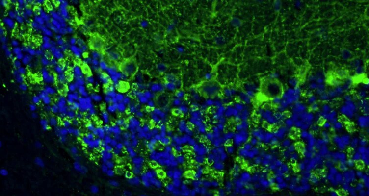 Immunohistochemistry-Paraffin: GAD65/67 Antibody (L127/12) - Chimeric - Azide and BSA Free [NBP3-52355]