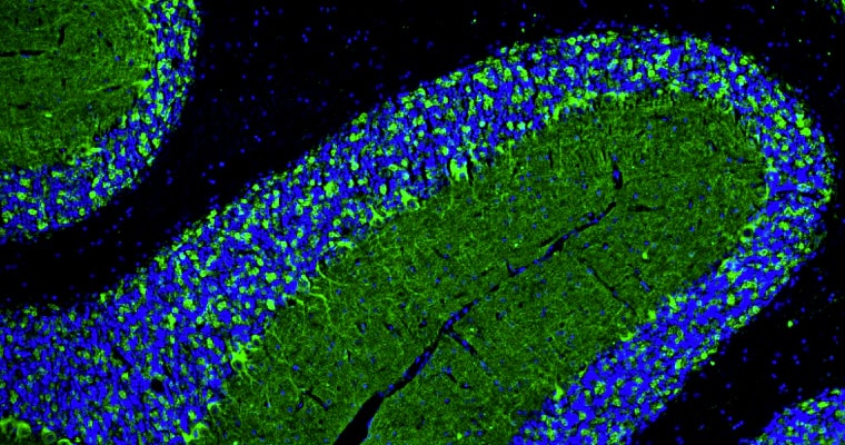 Immunohistochemistry-Paraffin: GAD65/67 Antibody (L127/12) - Chimeric - Azide and BSA Free [NBP3-52355]
