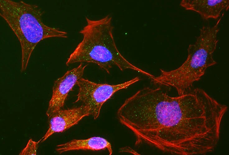 Immunocytochemistry/ Immunofluorescence: RAB9A Antibody (Clone 9) - Chimeric - BSA Free [NBP3-52358]
