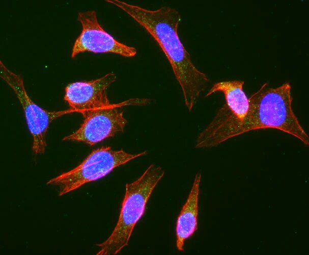 Immunocytochemistry/ Immunofluorescence: RAB9A Antibody (Clone 9) - Chimeric - BSA Free [NBP3-52358]