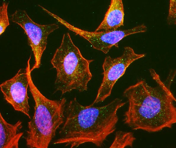 Immunocytochemistry/ Immunofluorescence: RAB9A Antibody (Clone 9) - Chimeric - Azide and BSA Free [NBP3-52359]