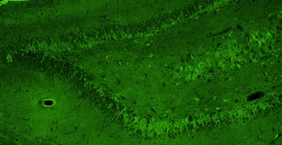 Immunohistochemistry-Paraffin: NMDAR2A Antibody (N327/95) - Chimeric - BSA Free [NBP3-52360]
