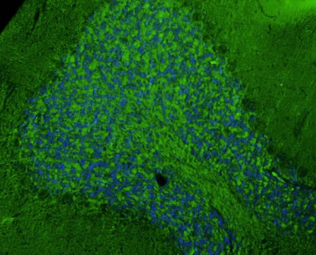 Immunohistochemistry-Paraffin: NMDAR2A Antibody (N327/95) - Chimeric - Azide and BSA Free [NBP3-52361]