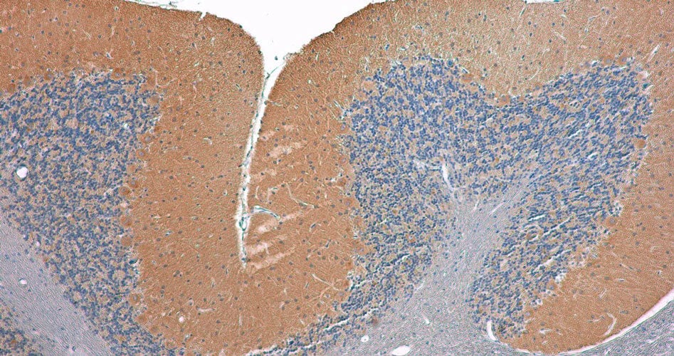 Immunohistochemistry-Paraffin: CACNA2D2 Antibody (N492/39) - Chimeric - Azide and BSA Free [NBP3-52363]