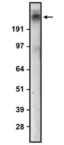 Western Blot: CACNA1E Antibody (N493/22) - Chimeric - Azide and BSA Free [NBP3-52365]