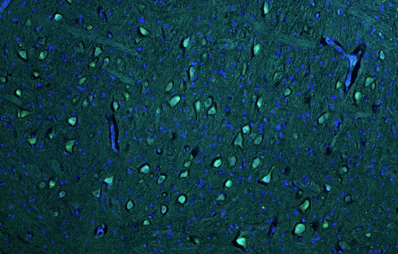 Immunohistochemistry-Paraffin: PINK1 Antibody (N4/15) - Chimeric - BSA Free [NBP3-52368]