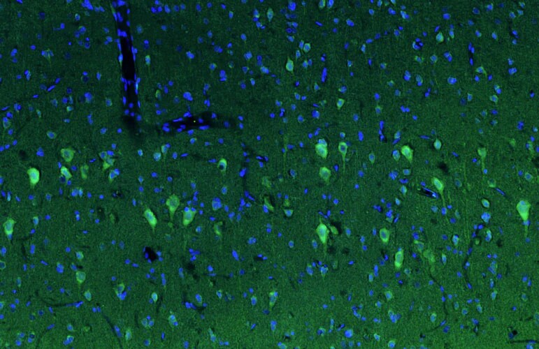 Immunohistochemistry-Paraffin: PINK1 Antibody (N4/15) - Chimeric - BSA Free [NBP3-52368]
