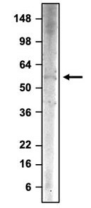 Western Blot: PINK1 Antibody (N4/15) - Chimeric - BSA Free [NBP3-52368]