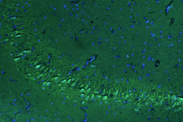 Immunohistochemistry-Paraffin: PINK1 Antibody (N4/15) - Chimeric - Azide and BSA Free [NBP3-52369]