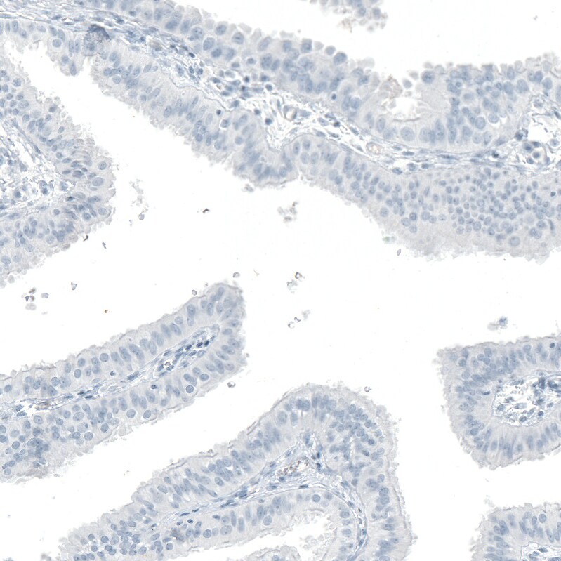 OTP Antibody (CL11225) Immunohistochemistry: OTP Antibody (CL11225) [NBP3-52439]
