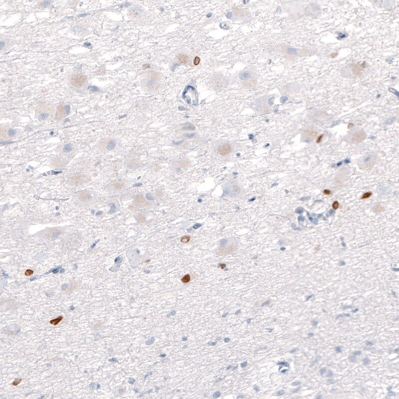 OTP Antibody (CL11225) Immunohistochemistry: OTP Antibody (CL11225) [NBP3-52439]