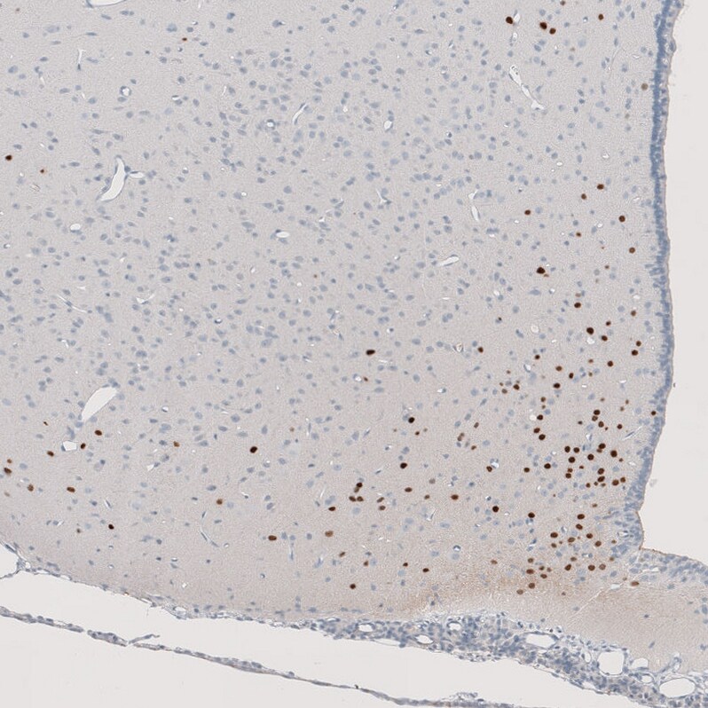OTP Antibody (CL11225) Immunohistochemistry: OTP Antibody (CL11225) [NBP3-52439]