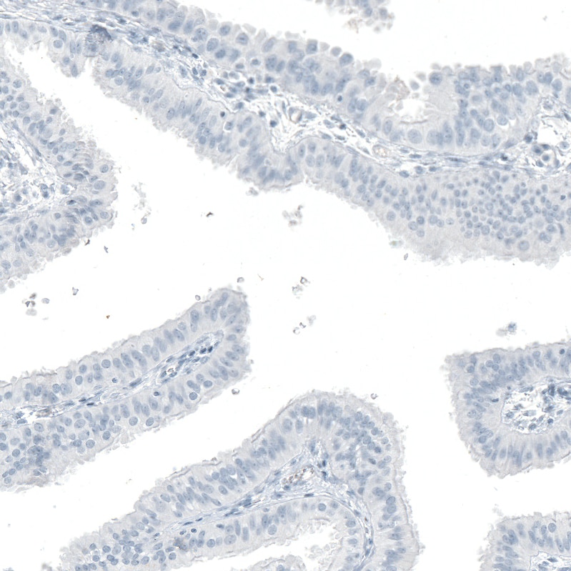 OTP Antibody (CL11225) Immunocytochemistry/ Immunofluorescence: SOX11 Antibody (CL0142) [NBP3-52441]