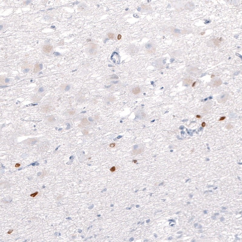 OTP Antibody (CL11225) Immunocytochemistry/ Immunofluorescence: SATB2 Antibody (CL0320) [NBP3-52448]