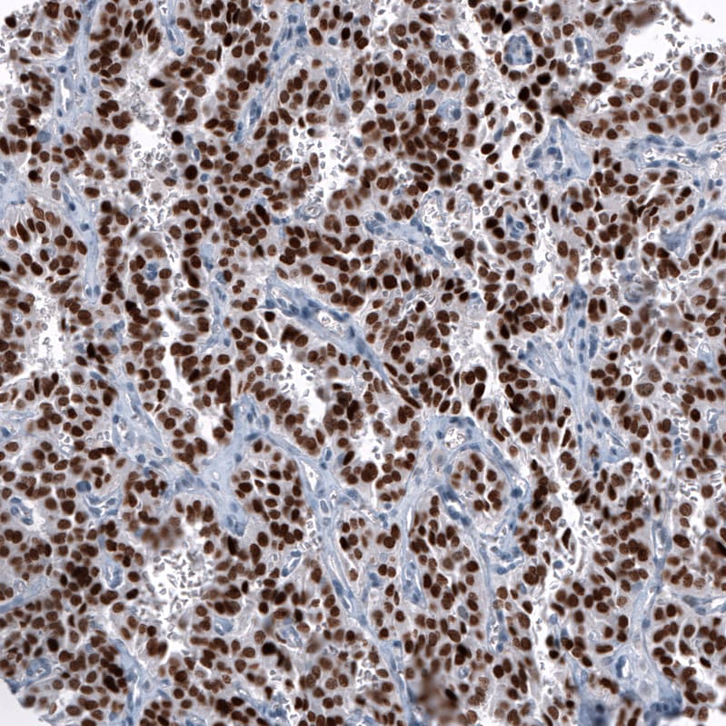 OTP Antibody (CL11225) Immunocytochemistry/ Immunofluorescence: Syntaxin 7 Antibody (CL0257) [NBP3-52445]