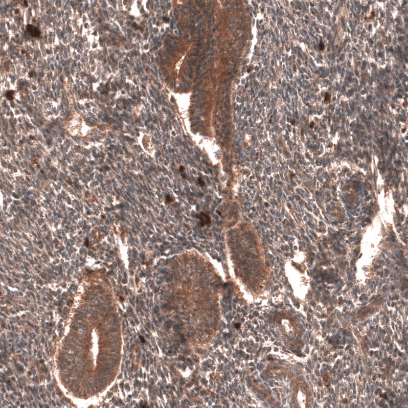 YAP1 Antibody (CL13628) Immunohistochemistry: YAP1 Antibody (CL13628) [NBP3-52440]