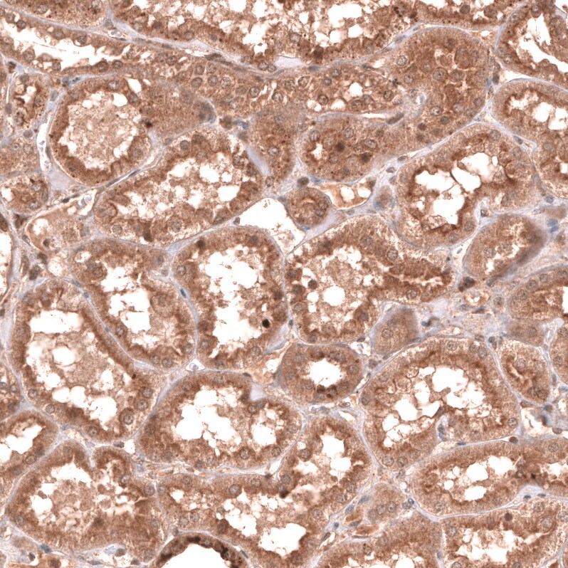 YAP1 Antibody (CL13628) Immunohistochemistry: YAP1 Antibody (CL13628) [NBP3-52440]