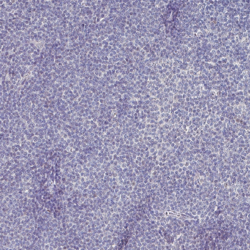 SOX11 Antibody (CL0143) Immunohistochemistry: SOX11 Antibody (CL0143) [NBP3-52442]