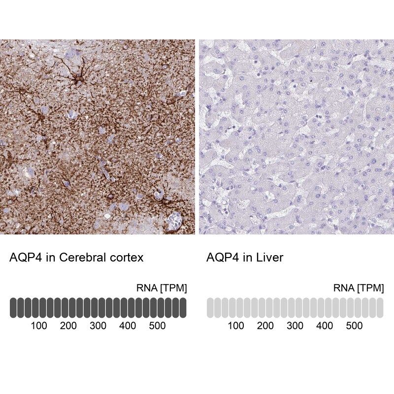 Aquaporin-4 Antibody (CL0178) Immunohistochemistry: Aquaporin-4 Antibody (CL0178) [NBP3-52443]