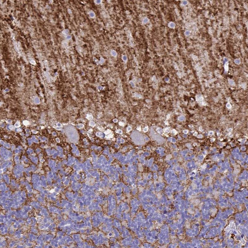 Aquaporin-4 Antibody (CL0178) Immunohistochemistry: Aquaporin-4 Antibody (CL0178) [NBP3-52443]