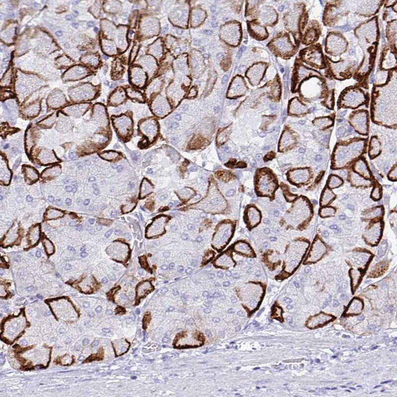Aquaporin-4 Antibody (CL0178) Immunohistochemistry: Aquaporin-4 Antibody (CL0178) [NBP3-52443]