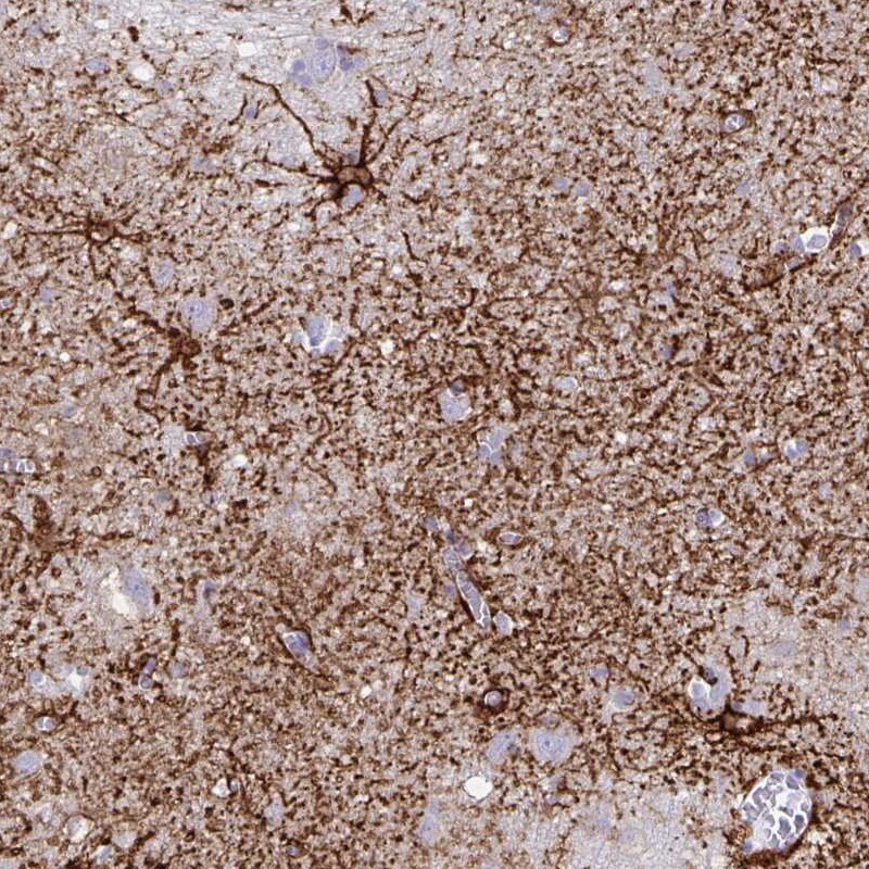 Aquaporin-4 Antibody (CL0178) Immunohistochemistry: Aquaporin-4 Antibody (CL0178) [NBP3-52443]